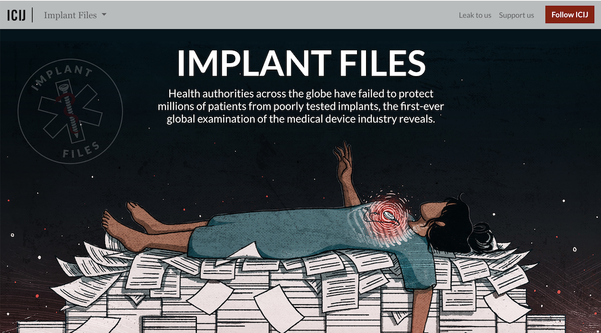 Implant files ()